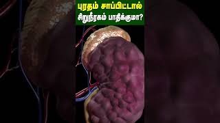 புரதம் சாப்பிட்டால் சிறுநீரகம் பாதிக்குமா  Does eating protein affect the kidney  Dr Arunkumar [upl. by Akcirderf625]