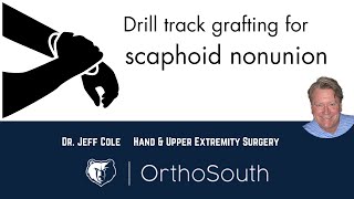 Scaphoid Nonunion Drill Track GraftingDr Jeff ColeOrthoSouth [upl. by Sadinoel]