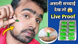 Evion 400 Capsule के असली सच्चाई  Evion 400 For Skin  Vitamin E Capsule For Skin  Evion 400 [upl. by Galligan]