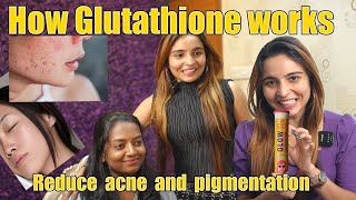 Bridal Skincare  Reduce Pigmentation with Chicnutrix Glow  How Glutathione Works [upl. by Goodard]