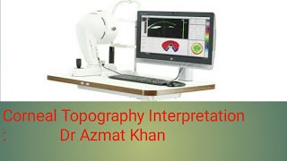 Corneal Topography Interpretation Part 33 [upl. by Ajnot982]