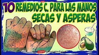 10 Remedios Caseros para las Manos Secas y Asperas Como Tener Manos Suaves e Hidratadas [upl. by Nnav175]