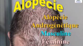 Chute de Cheveux  Alopécie androgenique chez lHomme et chez la Femme [upl. by Suhpoelc77]