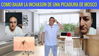 Picaduras de los mosquitos quitalos en 5 minutos con este remedio casero [upl. by Reggy]