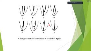 les lesions inflammatoires periapicales dorigine endodontique [upl. by Gnouh265]