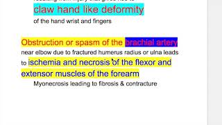 Volkmanns contracture [upl. by Jan]