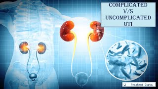 2 Complicated vs Uncomplicated UTI Urinary Tract Infections 8 [upl. by Nivar758]