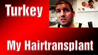 Hair Transplant Turkey Medical Exclusive Istanbul Experience Hair Loos [upl. by Getraer]