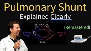 Shunting Explained Clearly Pulmonary Shunt  Remastered [upl. by Minton433]