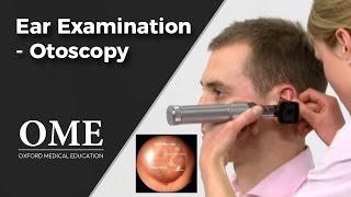 Otoscopy Ear Examination  ENT [upl. by Tait]