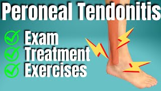 Peroneal Tendonitis Treatment  San Diego Sports Chiropractic [upl. by Hayifas364]