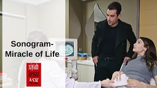 Siyah Beyaz Ask ❖ Ep 24 ❖ Sonogram  Miracle of Life ❖ English ❖ 2019 [upl. by Retrak]