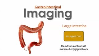 Imaging and barium of the large bowel DRE Prof Mamdouh Mahfouz [upl. by Ursa737]