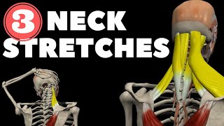 Neck Stretches for Instant pain relief [upl. by Samala535]