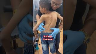 chiropractor Scoliosistreatment rkm drrajneeshkant [upl. by Oz752]