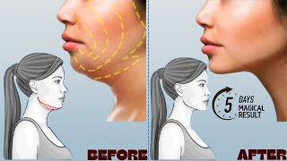 100 EFFECTIVE DOUBLE CHIN FAT amp FACE LIFT  UNIQUE FACIAL EXERCISES [upl. by Martz389]