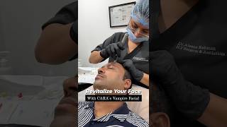 PRP Treatment For Face  Vampire Facial To Revitalize Face at CARA [upl. by Ashatan352]