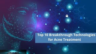 Top 10 Breakthrough Technologies for Acne Treatment [upl. by Thomson]