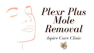 Plexr Plus Mole Removal [upl. by Primaveria]