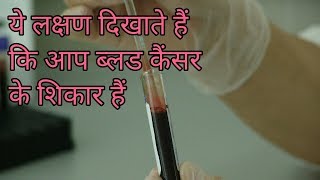 ब्लड कैंसर के लक्षण इन हिंदी blood cancer ke lakshan [upl. by Eyram]