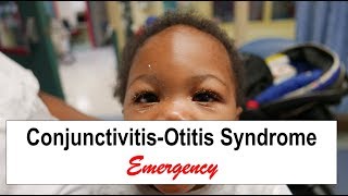 ConjunctivitisOtitis Syndrome Emergency [upl. by Urissa]