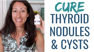 How to Reduce Thyroid Nodules and Thyroid Goiters Naturally [upl. by Letty]