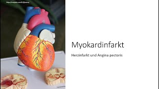 Herzinfarkt amp Angina pectoris einfach erklärt NSTEMI STEMI akutes Koronarsyndrom Risikofaktoren [upl. by Eded231]