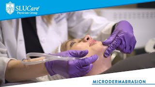 Microdermabrasion for Thick Pigmented and Sun Damaged Skin  SLUCare Cosmetic Dermatology [upl. by Dryden849]