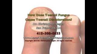 How Does Toenail Fungus Cause Toenail Discoloration [upl. by Keeryt]