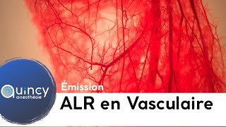 Emission ALR et chirurgie vasculaire 2019 [upl. by Akkimat]