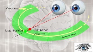 What is Fixation Disparity  Sub  ENG   Fixation Disparity part1 [upl. by Kalin]