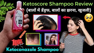 Ketoscore shampoo uses in hindi  Ketoconazole shampoo  Ketoscore shampoo review  Ketoscore [upl. by Nirrek]