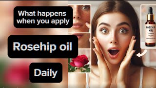 What happens when you apply rosehip oil on the face daily  let’s talk skincare [upl. by Ajad]