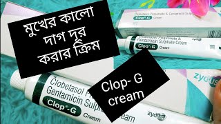 Clop G cream এর ব্যবহার মুখের কালো দাগ দূর করার ক্রিম tok forsa houyar cream clop G [upl. by Leizo824]