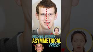 Fix Facial Asymmetry [upl. by Nemra]