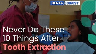 Never Do These 10 Things After Tooth Extraction [upl. by Gambrell286]