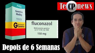 Fluconazol e a Dermatite Seborreica  Resultado depois de ingerir o comprimido 6 semanas [upl. by Hardman870]