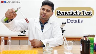 Benedicts Test  PrincipleProcedure and result  Benedicts Bangla benedicttest [upl. by Leinad]