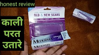 MEDERMA advanced scar gel Review in hindi  honest review by be alert product reviews [upl. by Aundrea]