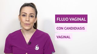 ¿Qué es un flujo como leche cortada [upl. by Erual]