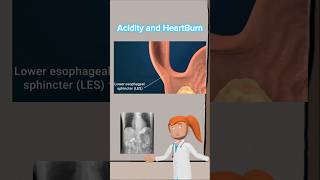 Acidity and HeartBurn youtubeshorts viralvideo fitness motivation ai cartoon animation neet [upl. by Yesnek]