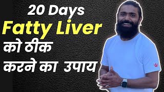 बिना दवाई के फैटी लिवर हीग सही  Yoga for Fatty Liver  Hira Yogi [upl. by Amii903]