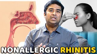 Understanding Nonallergic Rhinitis  Causes Symptoms and Treatment Dr Vignesh Gokul ENT Tamil [upl. by Jacquet]