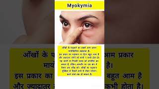 Whats myokymia healthfacts health medical medicalfacts healthcare medicaleducation shorts [upl. by Enerak86]