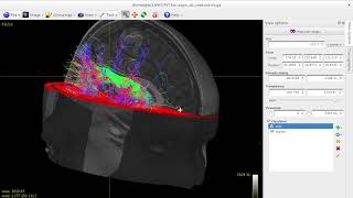 Tractography of arcuate fasciculus using MRtrix3 [upl. by Sineray468]