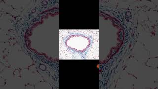 Massons Trichrome staining [upl. by Ragde]