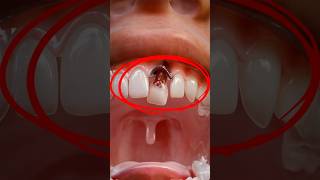 Swallowing A Tooth 😬 what happens shorts facts youtubeshorts trending trendingshorts [upl. by Esoj787]