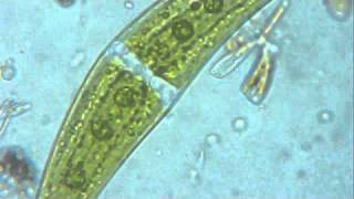 ALGA CLOSTERIUM ENTRE DIATOMS [upl. by Torbert]