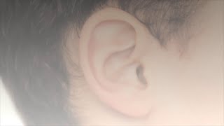 How a cochlear implant works [upl. by Saul850]