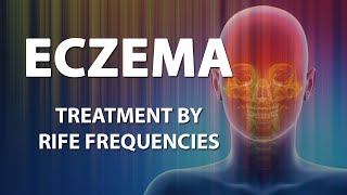 Eczema  RIFE Frequencies Treatment  Energy amp Quantum Medicine with Bioresonance [upl. by Anidan]